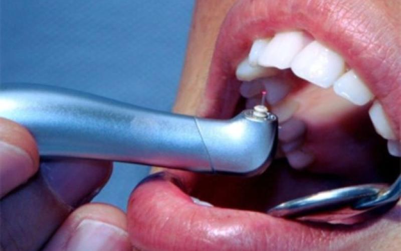 Les tarifs des soins dentaires dans le viseur de 60 millions de consommateurs.