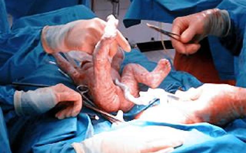 Un chirurgien oublie son mobile dans le ventre d'une patiente