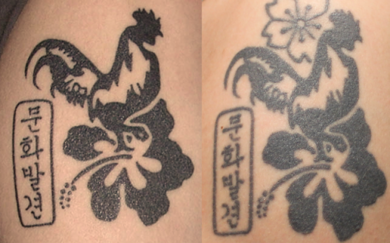 Conseils : attention, tatouage et bronzage ne font pas bon ménage !