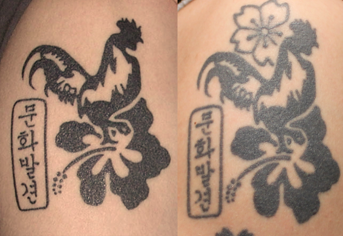 Conseils : attention, tatouage et bronzage ne font pas bon ménage !