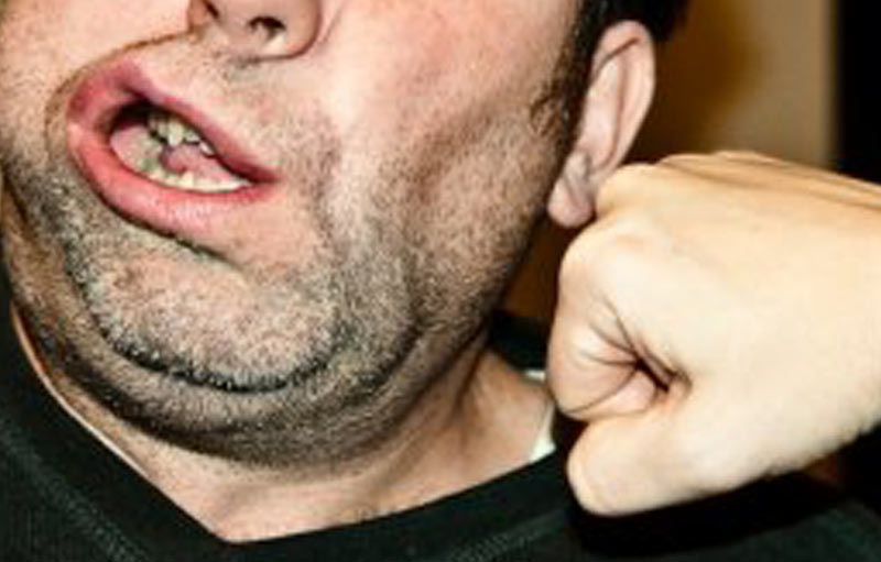 Trois blessés dans une bagarre entre garagistes en Moselle-Est